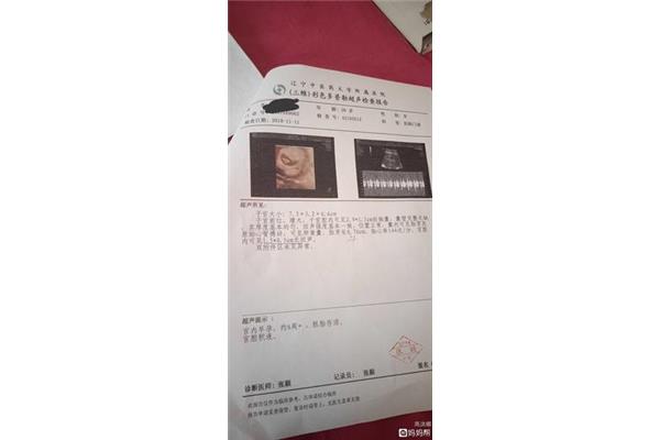 盆腔积液可以抽出来吗
